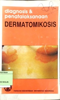 Image of DIAGNOSIS DAN PENATALAKSANAAN DERMATOMIKOSIS